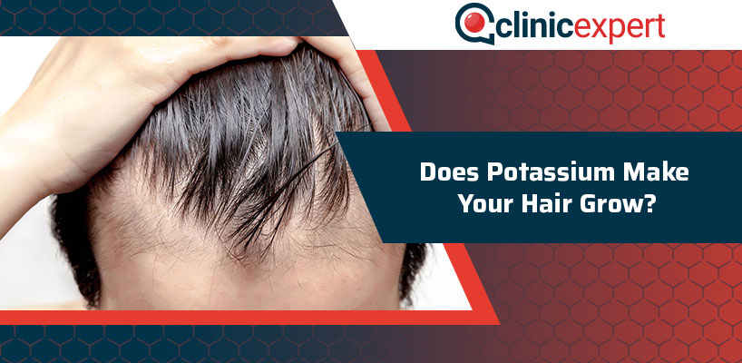 Can Low Potassium Cause Hair Loss